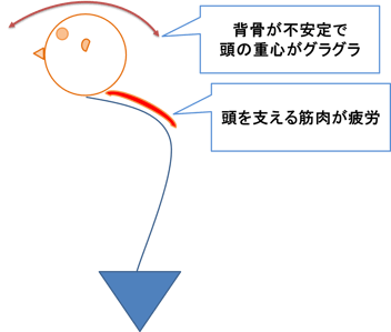 肩こりを起こす血行不良の原因に背骨の不安定性があげられます