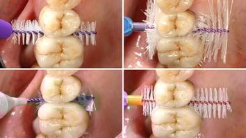 ParoSphère | Brossette interdentaire. Photo: © ParoSphère.