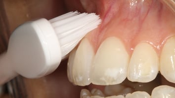 ParoSphère | Technique du rouleau simplifiée. Photo © ParoSphère.