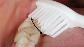 ParoSphère | Technique du rouleau simplifiée. Photo © ParoSphère.