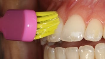 ParoSphère | Technique de Bass. Photo © ParoSphère.