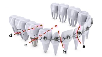 ParoSphère | Brossette interdentaire. Crédit photo: © rommma.