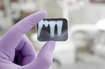 ParoSphère | Radiographie. Crédit photo : © milosljubicic