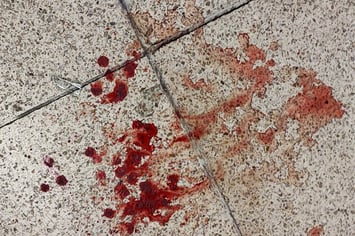 SC Int'l Street Combatives Krav Maga Selbstverteidigung Selbstschutz Kampfsport Traume psychische Erkrankung Gewalt Aggression Posttraumatische Belastungsstörung PTBS PTSD Vergewaltigung Tod Unfall 