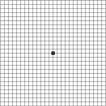 Sogenanntes Amslertestgitter. Alle Linien sollten gerade verlaufen.