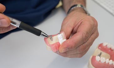 Zahnimplantate Implantate Oralchirurgie Kieferchirurgie