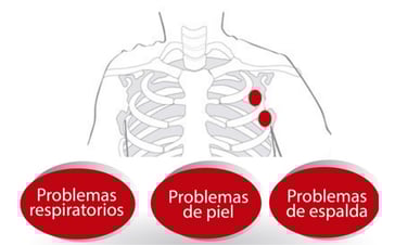 gesret asma psoriasis dermatitis atopica bebés 