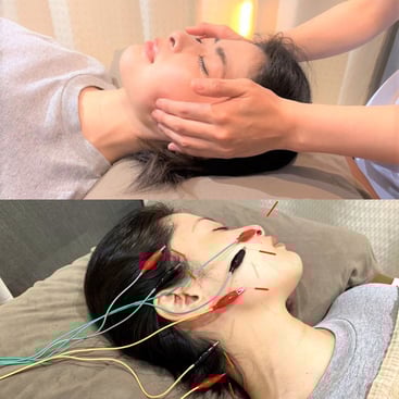 横浜駅　らいふ治療院　美容パルス鍼コース　小顔ソフト整体