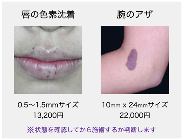 唇の色素沈着、腕のアザ