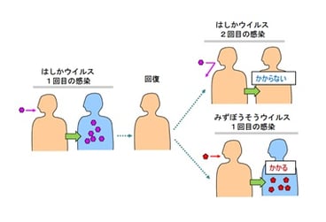 獲得免疫の特徴：はしかにかかった人は２度とはしかにかからないが、みずぼうそうにはかかってしまう