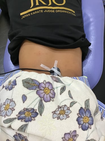 スポーツ中の腰の痛み