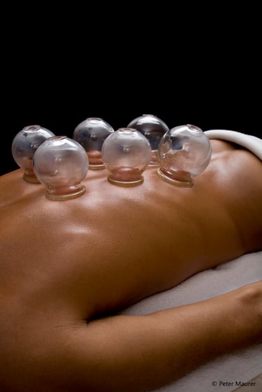 Schröpfen Praxis Kriens und Zürich Sabina Tundo