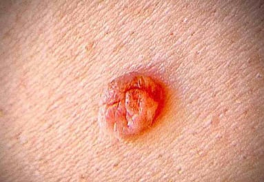 Wir sind ein überregionales Zentrum für Hautchirurgie - COPV Berlin