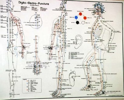 Points d'acupuncture