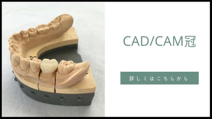 岐阜県多治見市の歯科技工所トーノーデンタルラボラトリーでは、CAD/CAMシステムの導入により、ジルコニア・ハイブリッドレジン技工物の設計から完成までを自社で行うことができます。スキャナーはMEDIT社、ミリングマシンはモディアシステムズ社を使用しています。