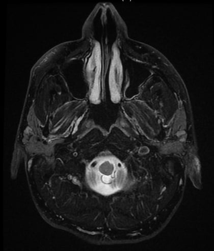 Glücklich sein, ist ein Gefühl, dass von innen kommt und im Kopf sitzt. Hier ein MRT-Bild von meinem Kopf.