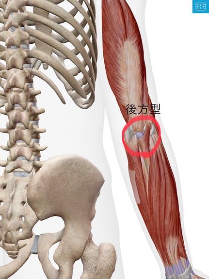 野球肘 リトルリーガーズエルボー