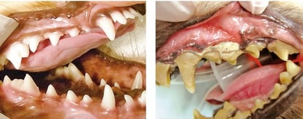 左：健康な歯｜右：歯周病の歯