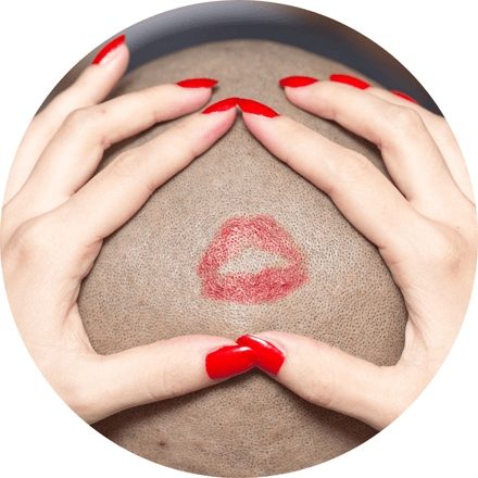 La bulle d'hair, photo représentant un cuir chevelu qui est la terre nourricière du cheveu