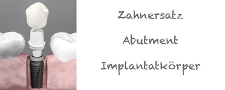 Implantatkrone Zahnersatz