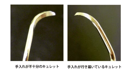 ・手入れが行き届いたキュレット