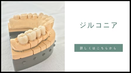 岐阜県多治見市の歯科技工所トーノーデンタルラボラトリーでは、CAD/CAMシステムの導入により、マルチレイヤー（グラディエーション）タイプ、フルクラウンタイプ、フェイシングタイプ、セラミックフルカバータイプと様々な症例に合った技工物を製作します。