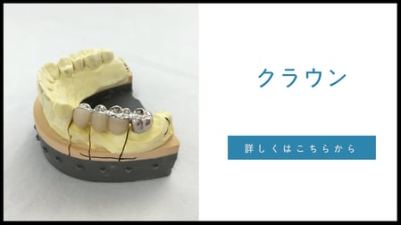 岐阜県多治見市の歯科技工所トーノーデンタルラボラトリーでは、保険から自費まで幅広く技工物を製作しています。インレー・クラウン・CAD/CAM冠から、メタルボンド・スポーツガード・ファイバーコアなど多くの製品を取り扱うので多くの歯科医院にご満足頂いております。