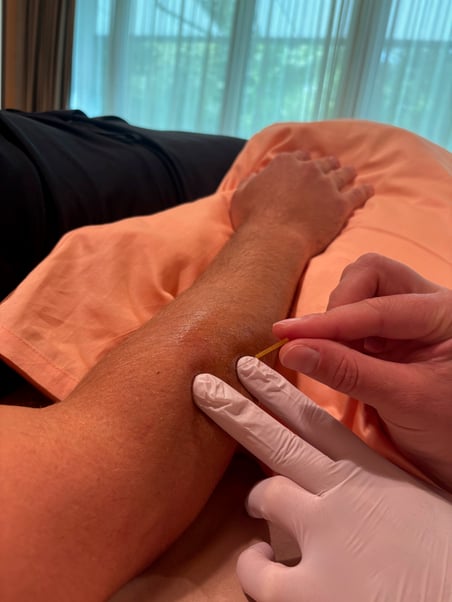 Triggerpunkttherapie in Basel Stadt