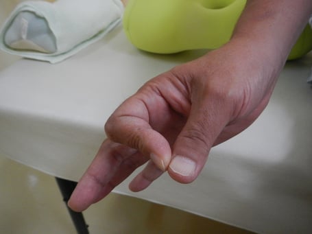 神経麻痺　　国分寺こみね鍼灸整骨院