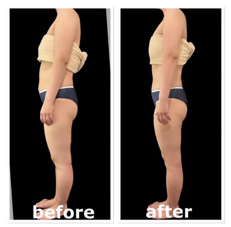 板橋区にあるリンパマッサージ専門店ファリンソの男性セラピストが施術したビフォーアフター横からみた写真