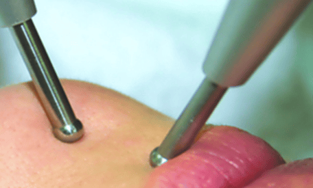 Lifting ohne Skalpell