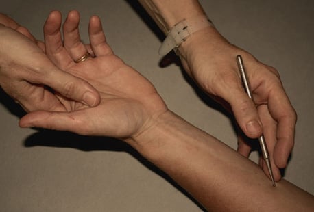 Meridian-Ausstreichng