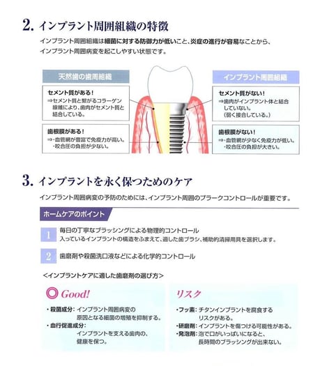 永井歯科医院 インプラント周囲炎とは 2