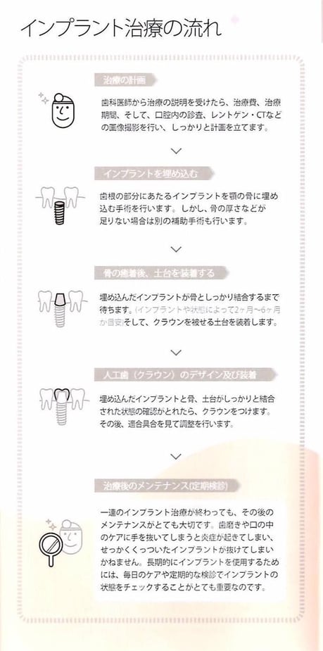 インプラント 茨木市 永井歯科医院 治療の流れ