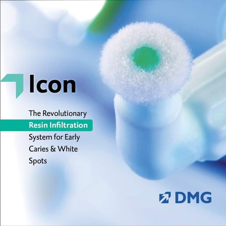 大阪 icon 永井歯科医院 茨木市 ホワイトスポット