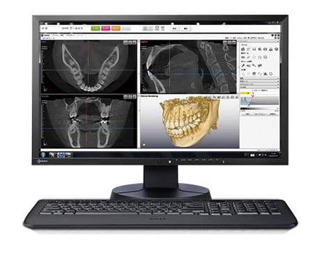 歯科用CT撮影 画像診断 永井歯科医院 茨木市