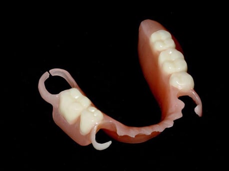 バネなし入れ歯 茨木市 永井歯科医院