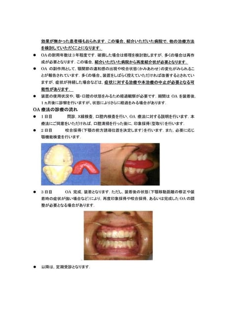睡眠時無呼吸症候群 治療の流れ 永井歯科医院 茨木市