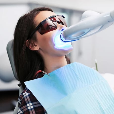 茨木市 ホワイトニング 永井歯科医院 イメージ２