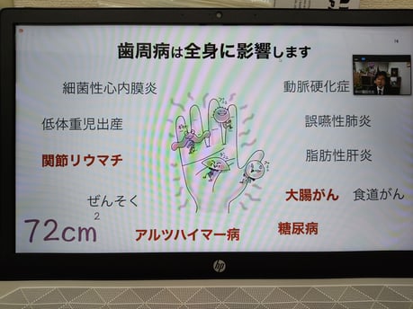 リステリン 茨木市 永井歯科医院 令和３年度 ブログ