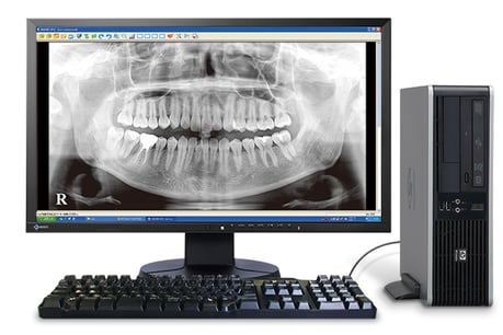 パノラマエックス線撮影 永井歯科医院 茨木市