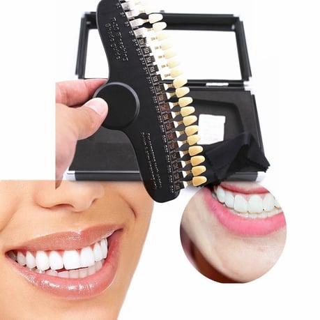 茨木市 ホワイトニング 永井歯科医院 イメージ４