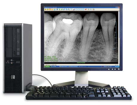 デンタルエックス線撮影 永井歯科医院 茨木市