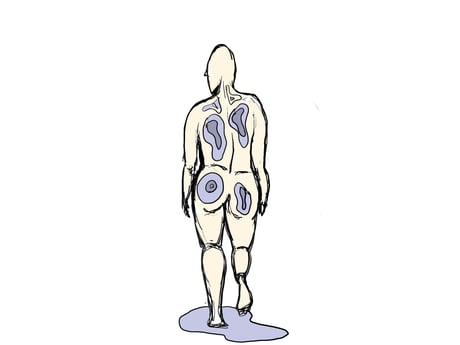 骨盤矯正 ゆがみ 姿勢 国分寺こみね鍼灸整骨院