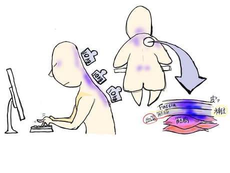 肩こり 頭痛 国分寺 こみね鍼灸整骨院