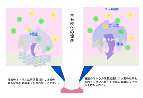 再石灰化の促進