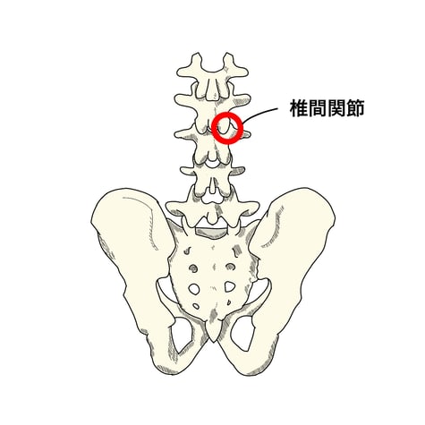 ぎっくり腰　椎間関節　　反ると痛い