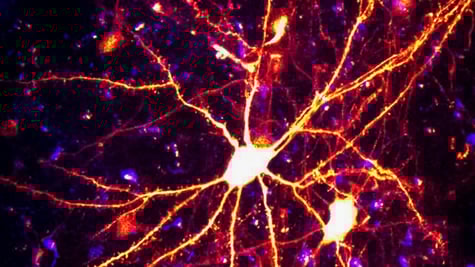 Reconstitution du réseau neuronal d'un oiseau chanteur, impliqué dans l'apprentissage du chant (projet BRAIN)