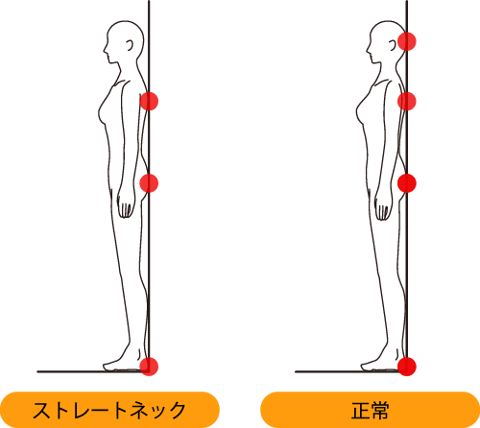 簡単なストレートネックの調べ方