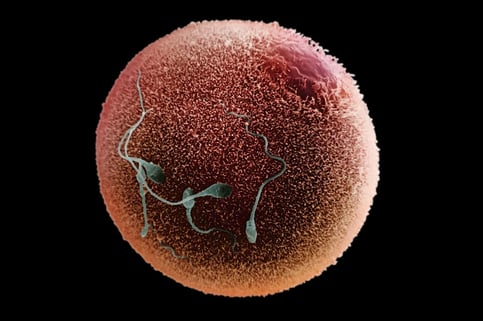Un trio de protéines permet à un spermatozoïde (coloré artificiellement) de s'arrimer à un ovule. Crédit : D. Phillips/Science Photo Library
